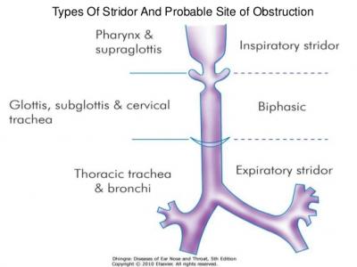 stridor-4-638_0.jpg